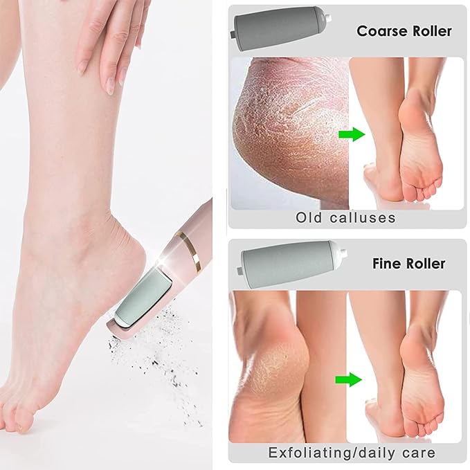 ELECTRIC FEET CALLUS REMOVER